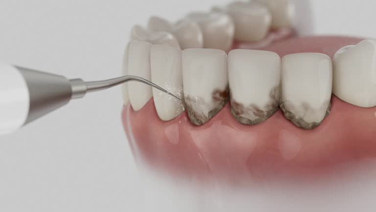 Trusted Invisalign Clear Aligners service in Parsippany, NJ - Dentist Open Now